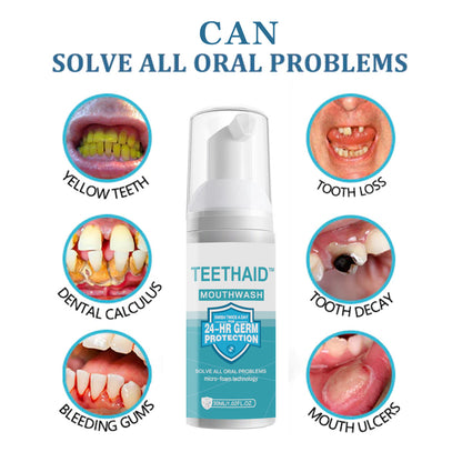 💥Hot Listing 🔥Teeth Cleaning Mousse Toothpaste 7.5% for Enamel Repair & Teeth Whitening Refreshing Flavor Fluorid