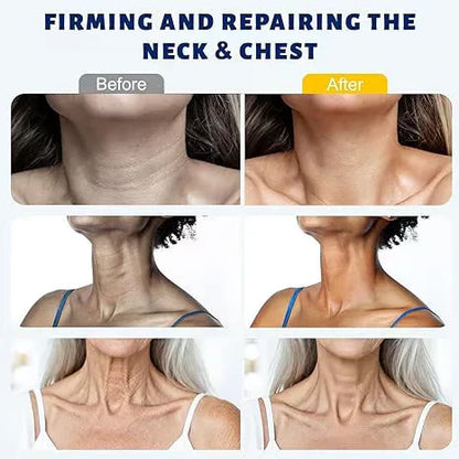 Roller Massage Neck Cream 🧴 Collagen & Hyaluronic Acid | Firms Neck, Reduces Wrinkles & Double Chin
