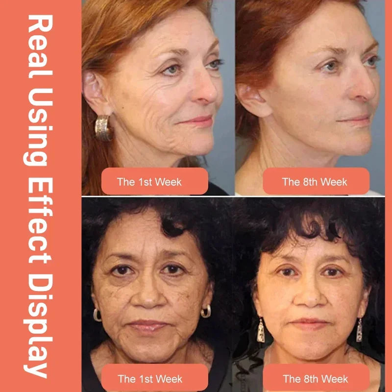 🎁2025 Hot Sale🎁DRAGONS BLOOD EASY CREAM