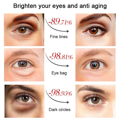 24K Gold Moisturizing Eye Mask-BUY 1 GET 1 FREE