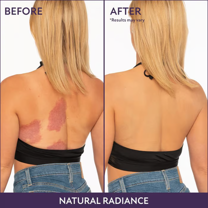 🎁Buy One Get One Free🎁 - All Over Complexion Perfector