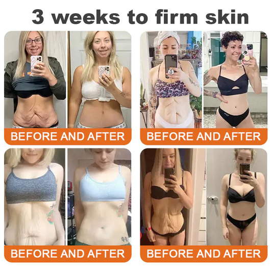 🐝🏅Flysmus™ Botox Bee Venom Firming Serum Stick-(Made and Shipped from Australia)-LAST DAY 70% OFF