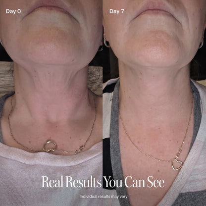 🔥LAST DAY BUY 1 GET 1 FREE🔥CELESTVÉRA Face Slimming Cream