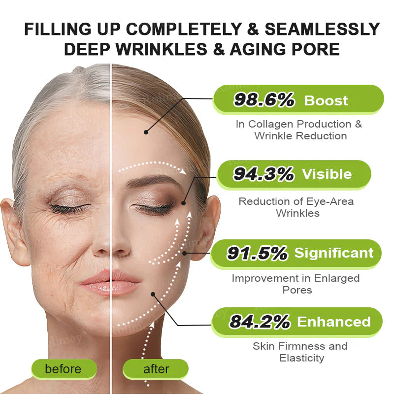❤️Rolimey® Botox & Vita-A Retinol Shot Wrinkle💫-Lift Tightening cream - Last Day Promotion 50% OFF
