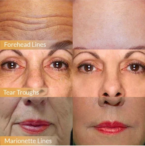 🔥2025 Hot🔥 Sale Polypeptide Firming Full Face Cream