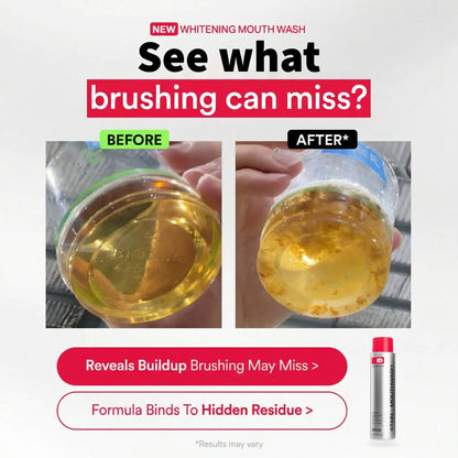 Buy 1 free 1🦷Power Stain-Removing Mouthwash – Brighter Teeth in Every Rinse 💎