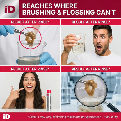 Buy 1 free 1🦷Power Stain-Removing Mouthwash – Brighter Teeth in Every Rinse 💎